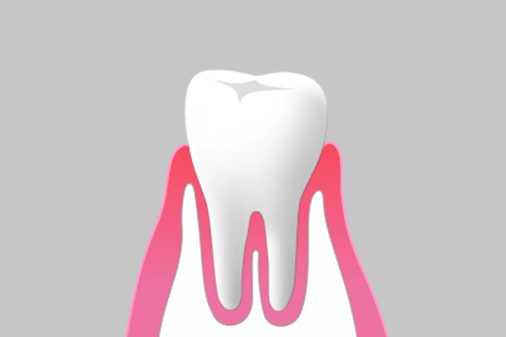 健康な歯